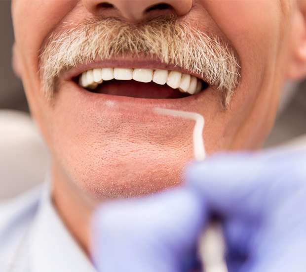 Foothill Ranch Adjusting to New Dentures