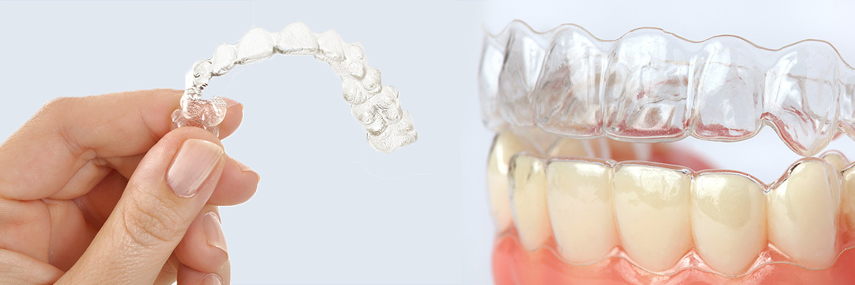 Foothill Ranch Alternative to Braces for Teens