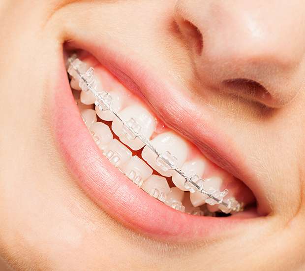 Foothill Ranch Invisible Orthodontics