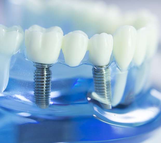 Foothill Ranch Dental Prosthetics