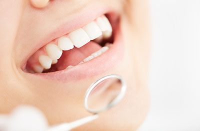 Schedule A Dental Restoration And Save Your Tooth