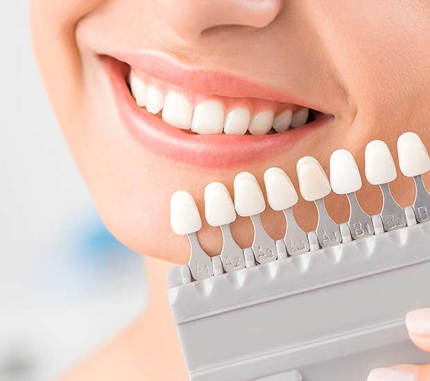 Foothill Ranch Dental Veneers and Dental Laminates