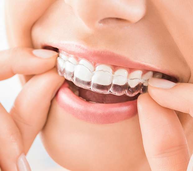 Foothill Ranch Does Invisalign® Really Work?