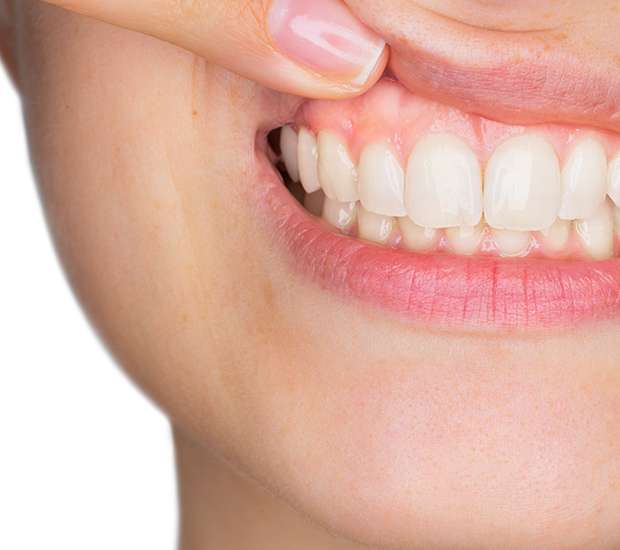 Foothill Ranch Gum Disease