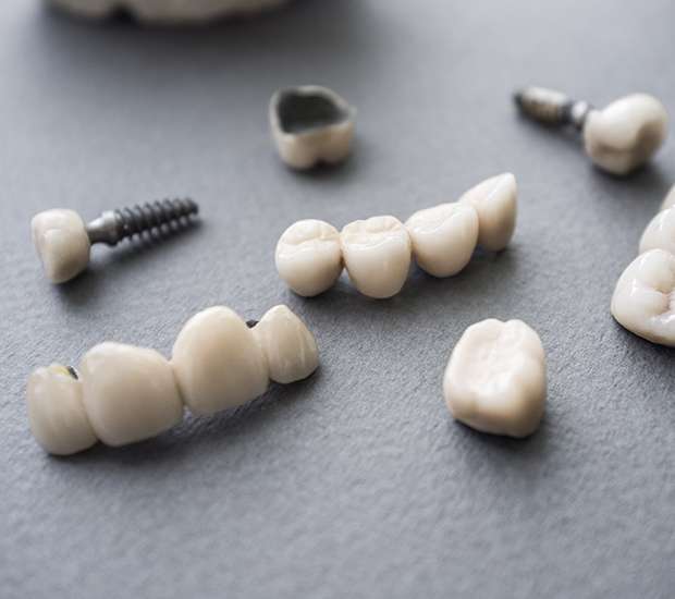 Foothill Ranch The Difference Between Dental Implants and Mini Dental Implants