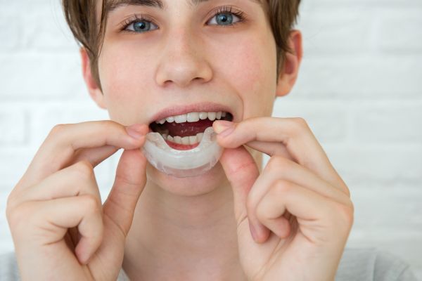 How Mouth Guards Can Protect Your Teeth While Playing Sports