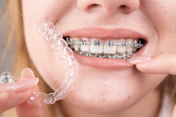When Is Early Orthodontics Necessary?