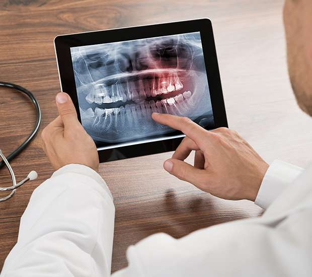 Foothill Ranch Types of Dental Root Fractures
