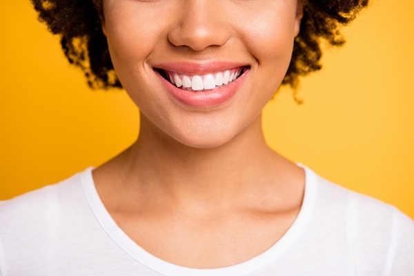 Will Veneers Need To Be Replaced?